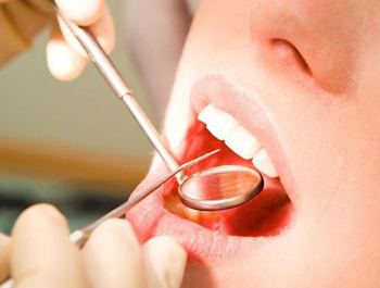 种植牙后应该如何护理?